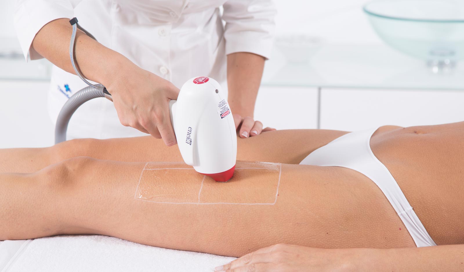 legs-laser-treatment