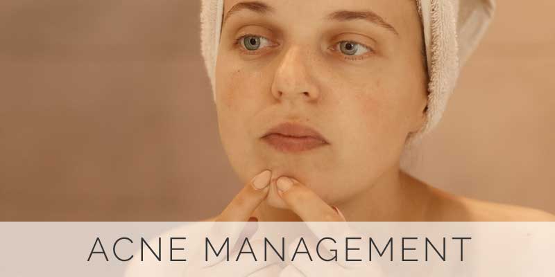acne-management