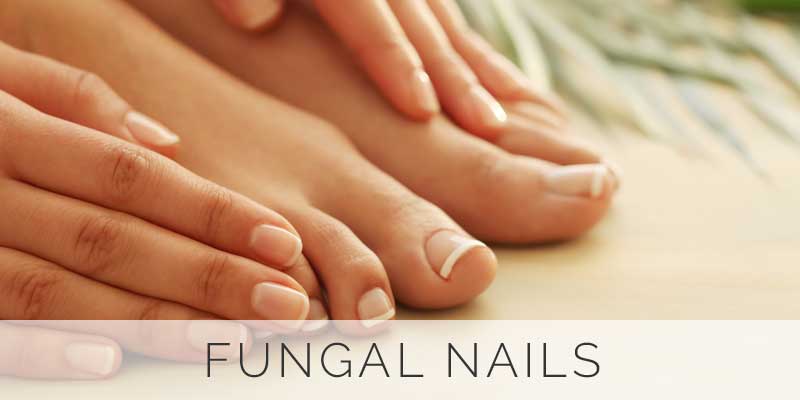 Fungal-Nails