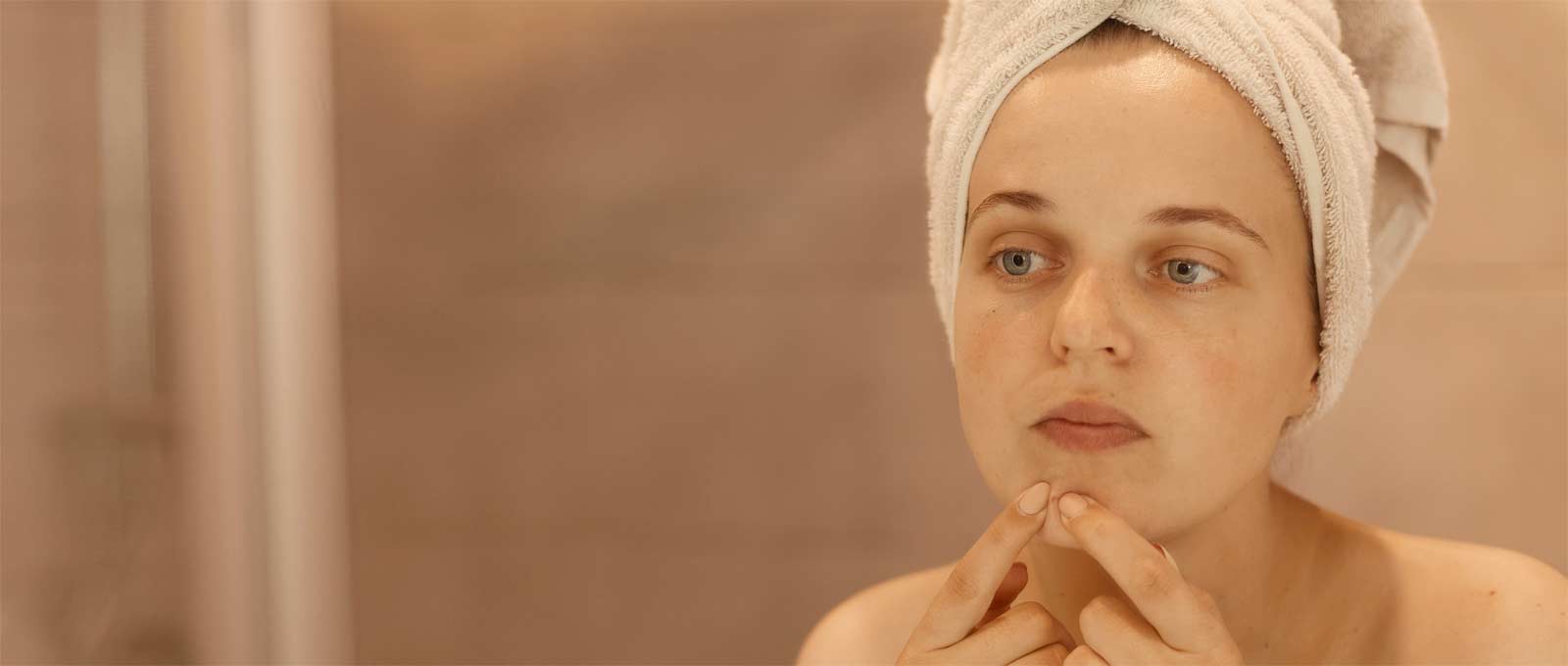 acne-laser