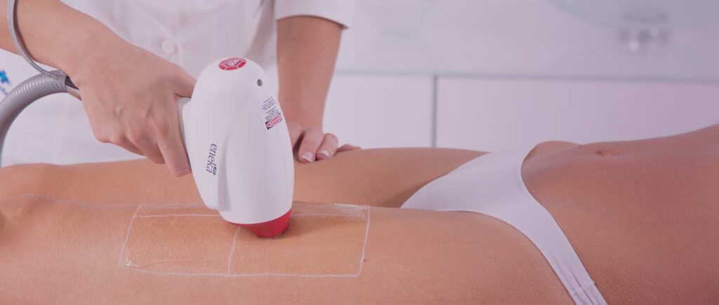 Header-Eneka-Laser